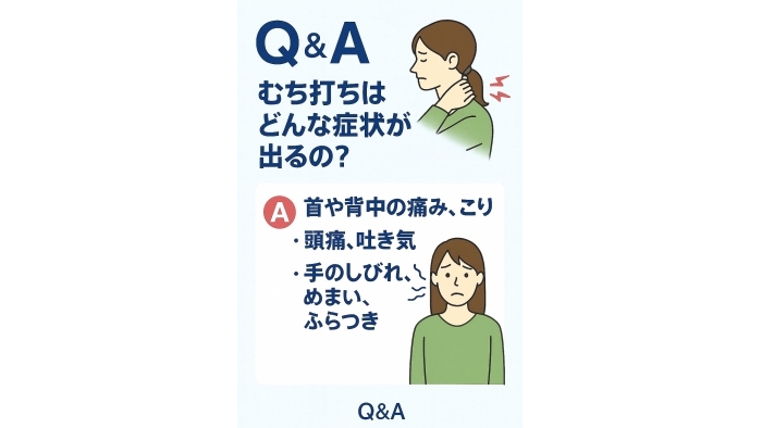 尾張旭市　鍼灸接骨院　【Q&A：むち打ちはどんな症状が出る？】